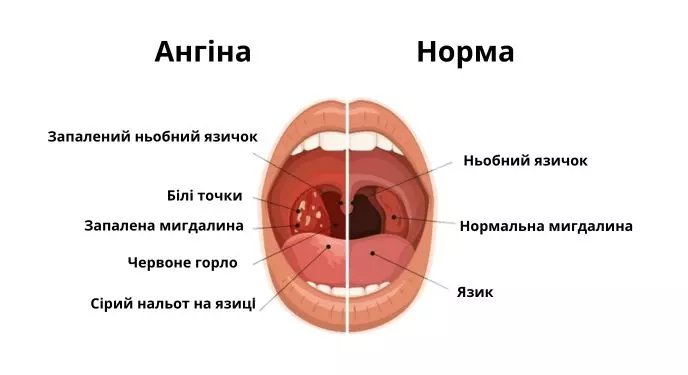 7fb8bbfa5a966eadf2d853269e6d9778